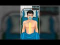 Open heart surgery doctor games  gameplay trailer  hospital surgery games