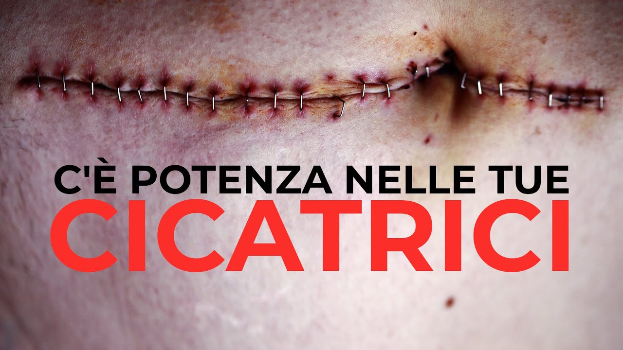 C'è Potenza Nelle Tue Cicatrici | Antonio Morra [Predicazione]