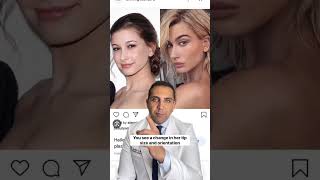 Did Hailey Bieber get Plastic Surgery? Net Worth