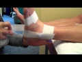 Ankle Taping Following Sprains or With Pain and Instablity