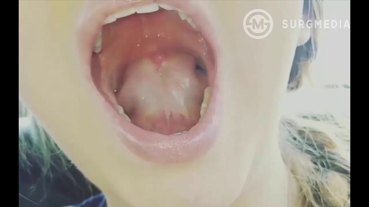 What does your tongue do when you swallow?