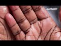 Handwashing Day 2025