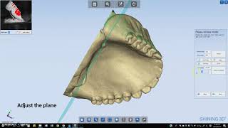 Denture scanning with Autoscan-DS-EX (Shining3D Tech)