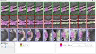 Demo of sheet splitting in khartes volume annotation