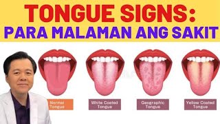 Tongue Signs: Para Malaman ang Sakit. - By Doc Willie Ong (Internist and Cardiologist)
