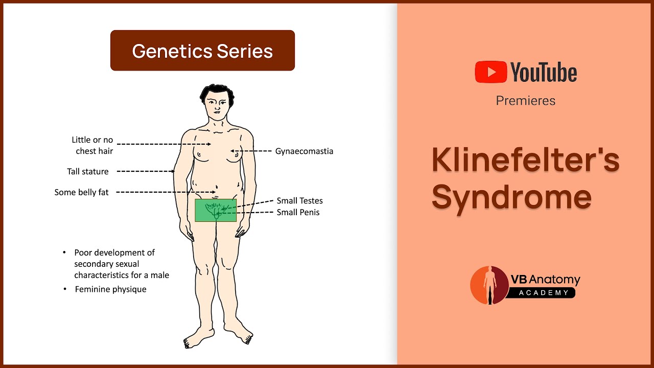 Klinefelter's Syndrome Explained: Genetics, Characteristics, and ...