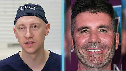 Simon Cowell NEW FACE | Plastic Surgery Analysis