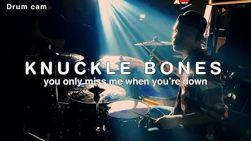Knuckle Bones - you only miss me when you