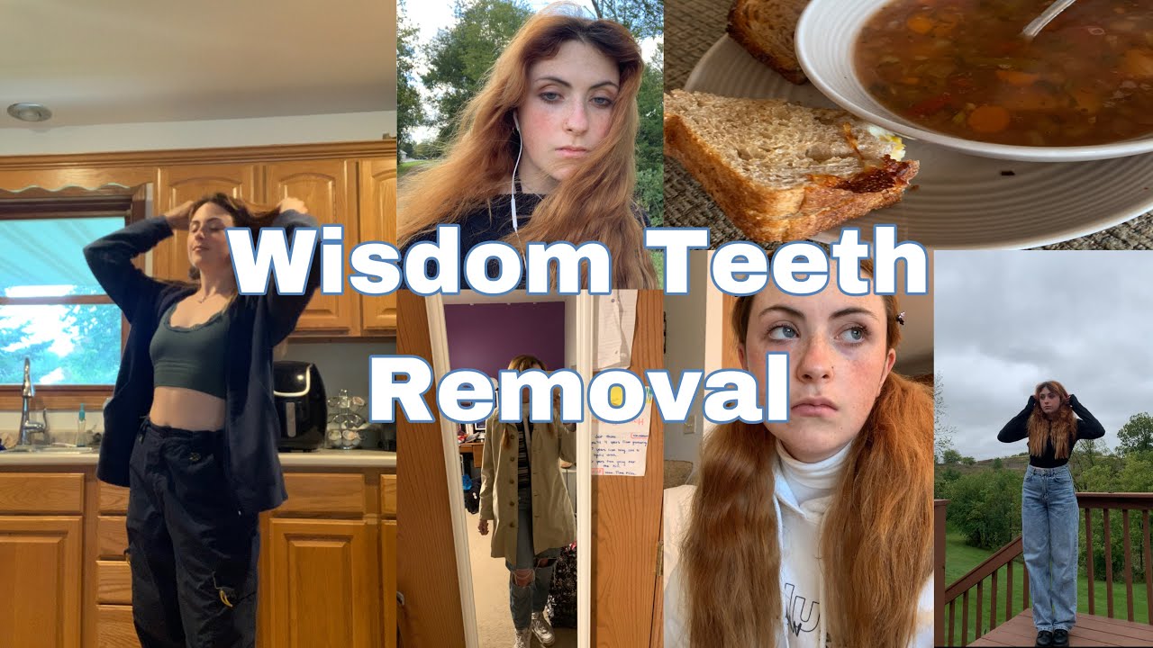 WEEKLY VLOG Wisdom Teeth Removal YouTube