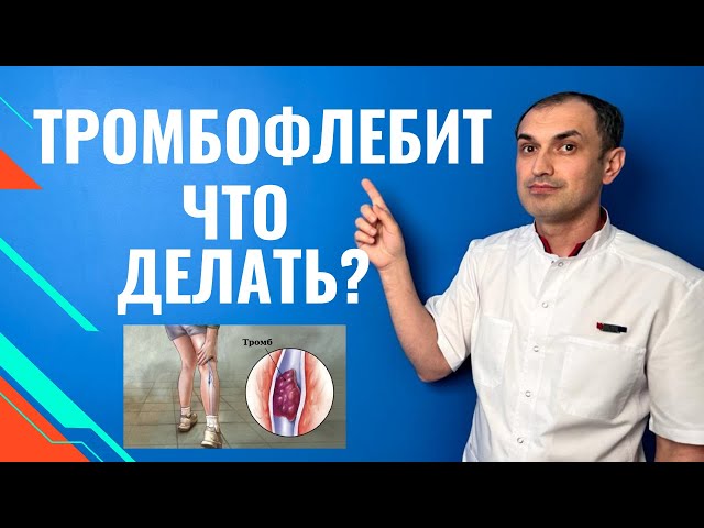 Тромбофлебит как выявить самостоятельно. Флеболог Москва.