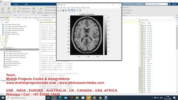 Medical image noise removal using CNN and image composition using MATLAB || MATLAB projects