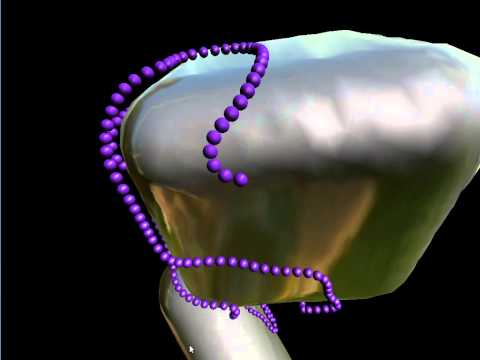 Improved snake on implicit surfaces