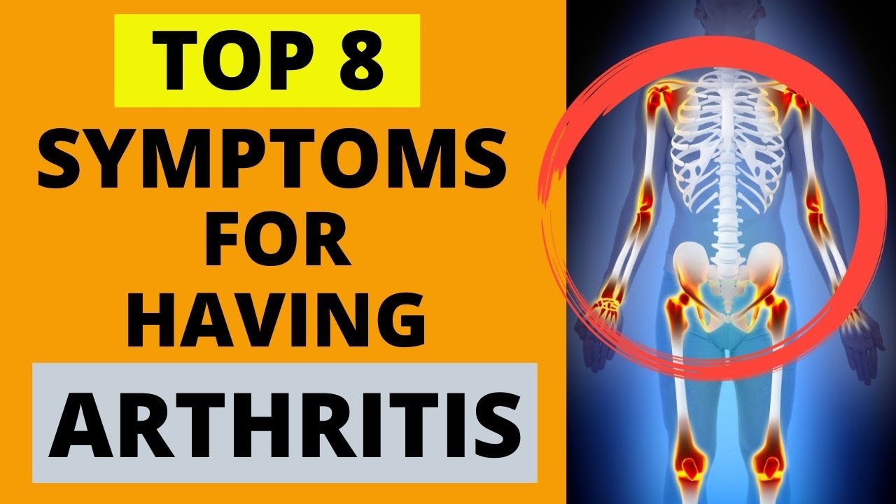 ARTHRITIS SYMPTOMS AND TREATMENT Pain Relief Home Remedies YouTube