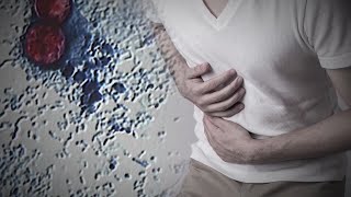 Cyclospora outbreak in local produce, experts say