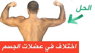 عدم توازن العضلات - Muscle Imbalance