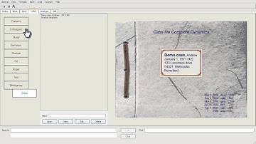 Complete Dynamics - Analysis module - Quick start