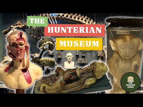 London's Grisliest Museum? A Guided Tour of The Hunterian Surgical Museum