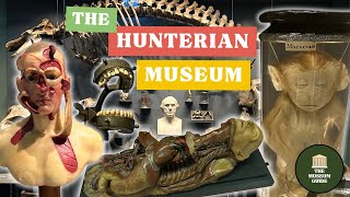 London's Grisliest Museum? A Guided Tour of The Hunterian Surgical Museum