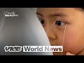 【VICE】9歳の幼女がした二重まぶたの整形手術