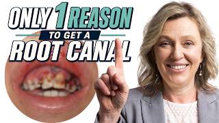 The Only Time I Would Recommend a Root Canal