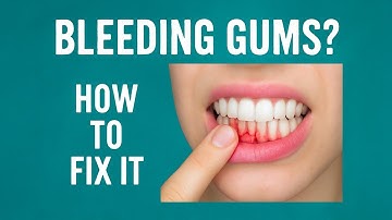 Bleeding Gums? Here