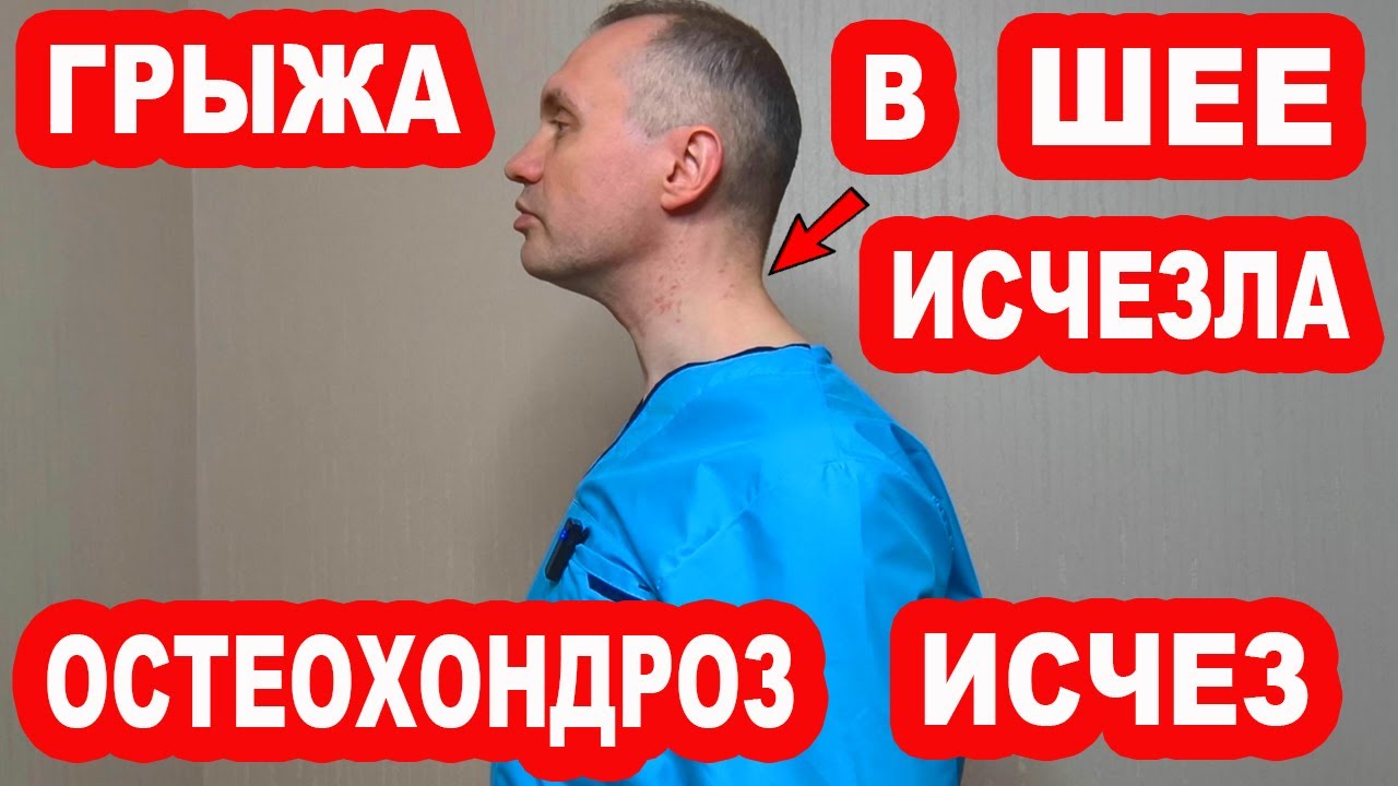 ГРЫЖА шейного отдела позвоночника. Эти упражнения быстро вылечат ГРЫЖУ в шее и Остеохондроз!