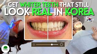 Natural-Looking results Teeth Whitening 🦷✨