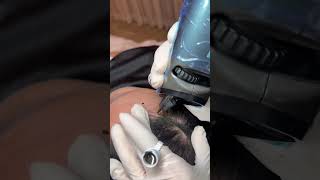 Soft Hairline Enhancement – SCATTER Scalp Technique #HairlineDesign#SMPTechnique#NaturalResults
