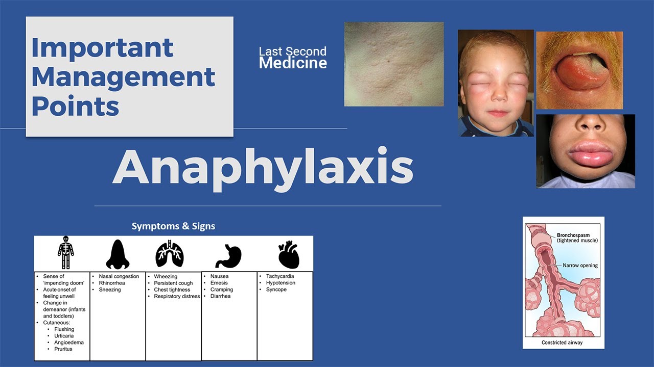 Anaphylaxis Airway