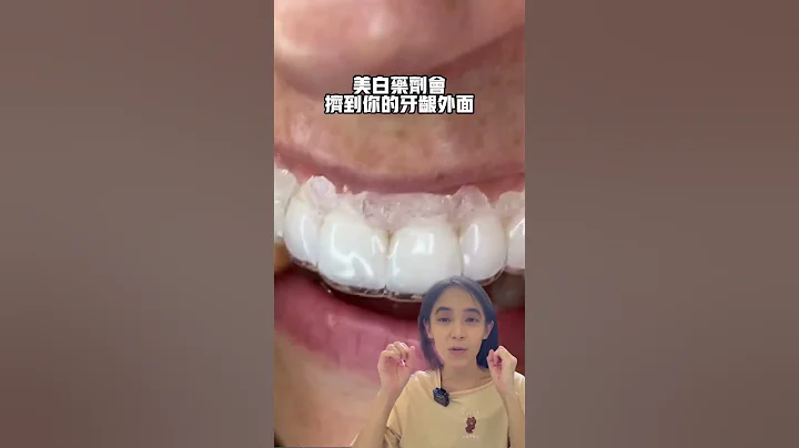 牙套維持器可以當美白牙托使用嗎#牙齒矯正#牙齒美白 - 天天要聞
