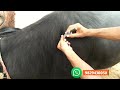 Intramuscular injection