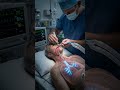 Can’t Breathe? See How Doctors Manage Airway Emergencies