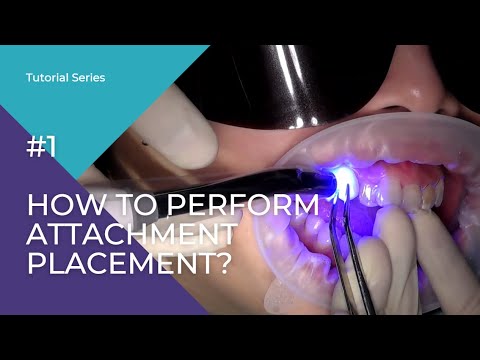 TrioClear™ Tutorial Series #1 - How to perform Attachment Placement?