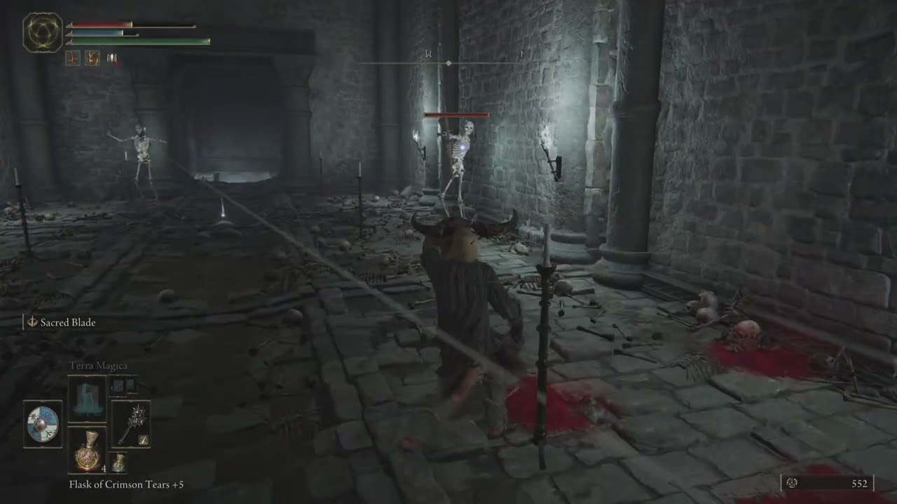 My Most Embarrassing Death in ELDEN RING