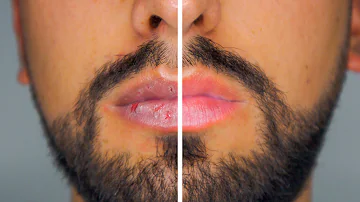 ¿Cómo hidratar los labios después de besar?