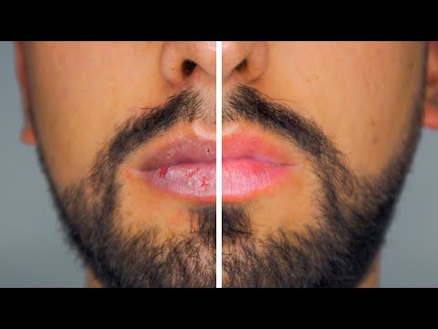Video: ¿La vaselina ayuda a los labios agrietados?