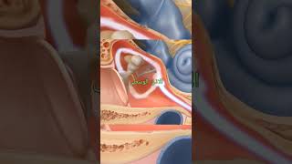 التهاب الاذن الوسطى ??علاج طبي اسباب ترند اسعافات_اولية تخدير عملية