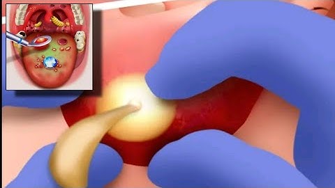 Screw Frenzy ASMR Part 5 Walkthrough Gameplay Android,iOS