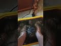 Проявление интоксикации помогает снять аппарат "Детокс".