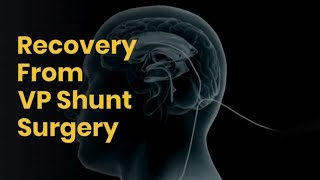 Post VP Shunt Surgery Recovery | Life After VP Shunt Surgery | Lyfboat