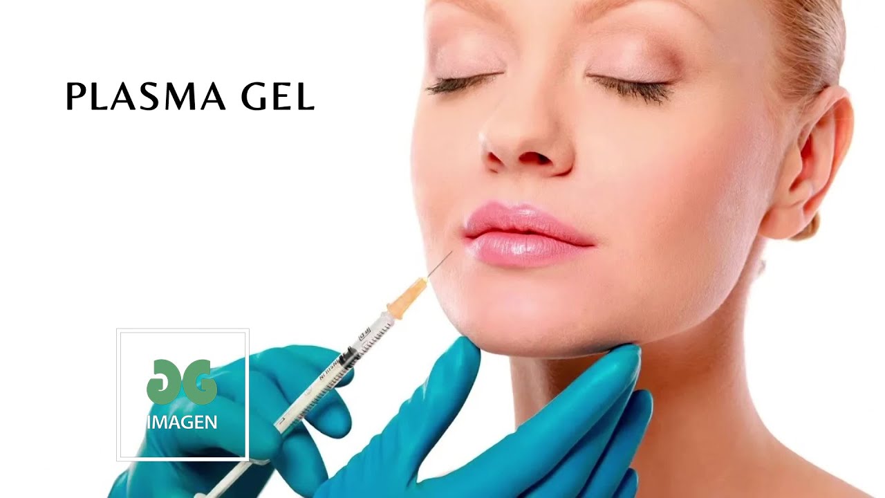 Plasma gel