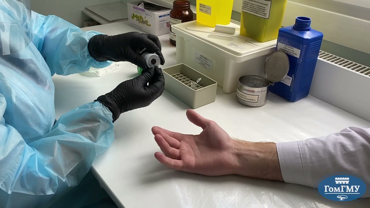 Основные методы измерения глюкозы в крови