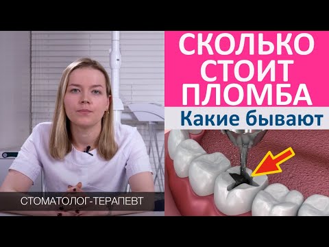 Зубная пломба - цена, какие виды пломб для зубов бывают. От чего зависит стоимость пломбы.