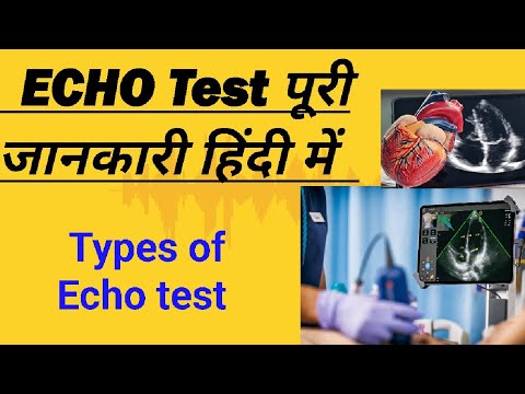 Echo test! Types और Procedure पूरी जानकारी! Echocardiogram! दिल का इको ...