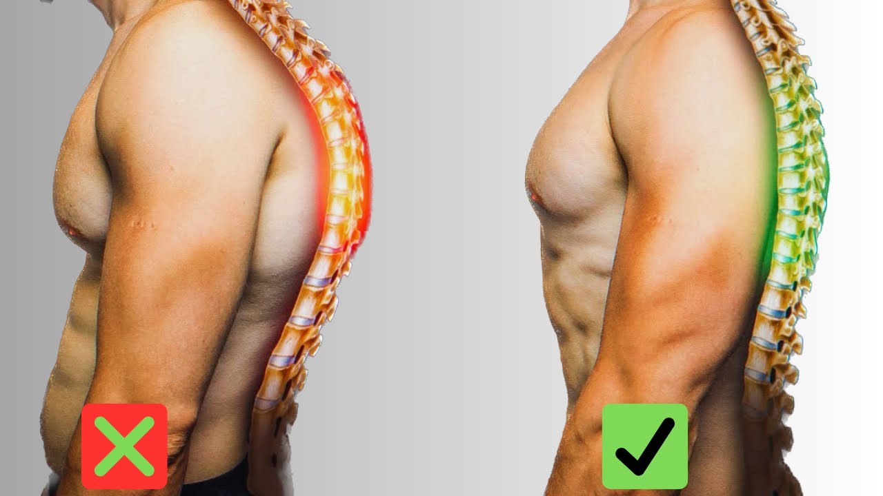 Fix Rounded Shoulders! | Fix Hunchback Posture! | Exercises to Improve ...
