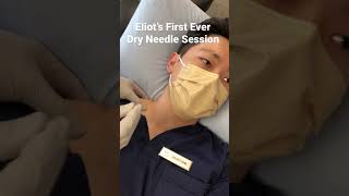 Will it Twitch? Dry Needling the Upper Trapezius Muscle