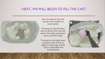 How A Custom TLSO Is Made Part 4: The Filling Process