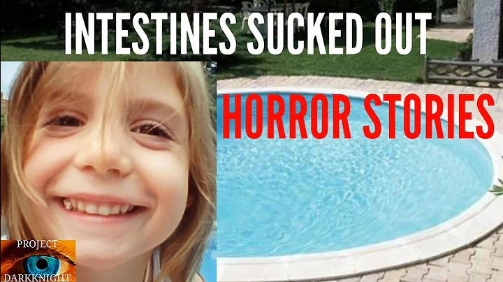 Intestines Sucked Out Of Girl Of 6 After Sitting O...