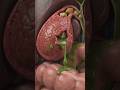 Gallbladder Rupture: अंदर क्या होता है?😱#humanbody #Gallbladder #Gallstones #viral #anatomy
