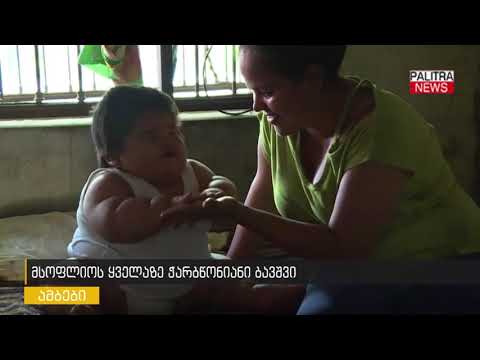 მსოფლიოს ყველაზე ჭარბწონიანი ბავშვი